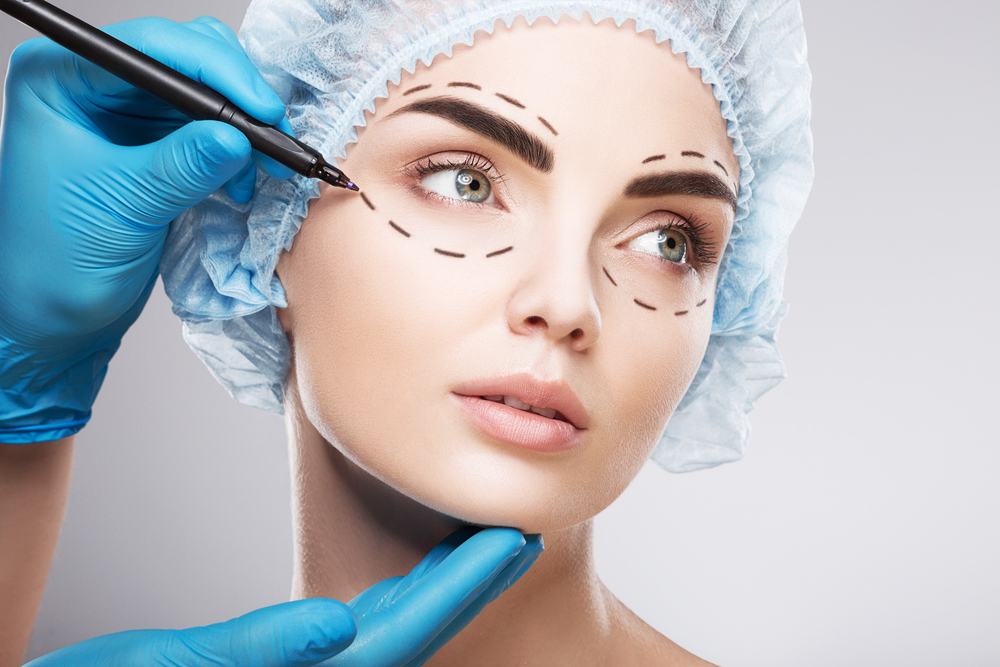 Image of female face with a doctor's hands making lines near eyes for cosmetic surgery.