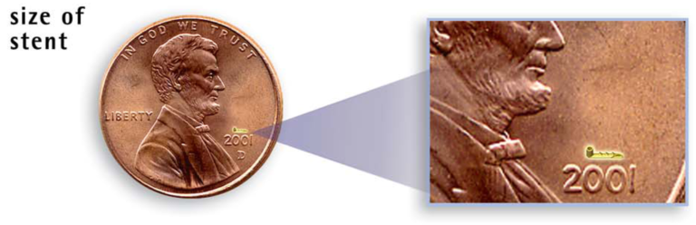 Size comparison of stent used for glaucoma surgery; smaller than the year stamped on US penny