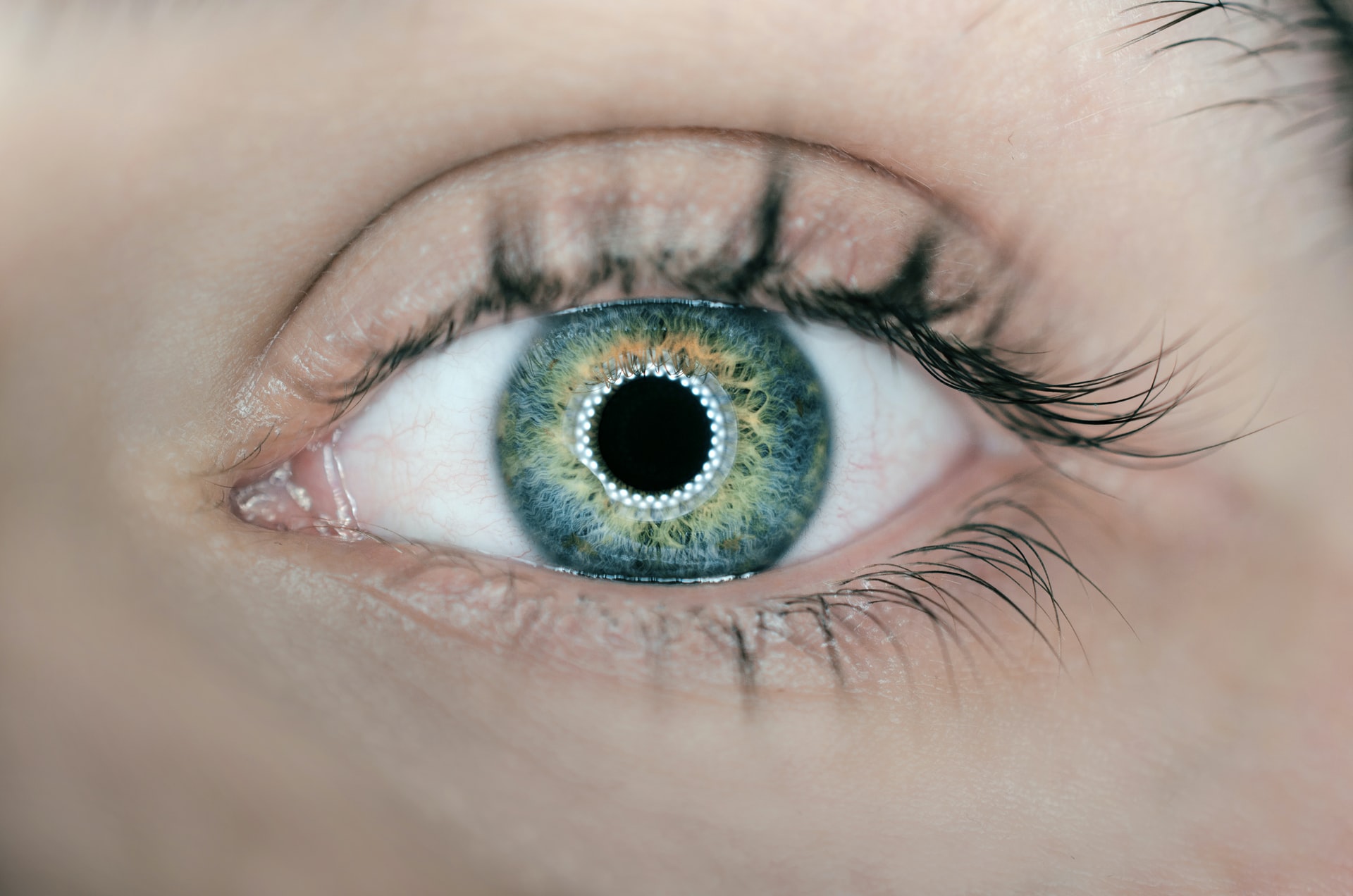 Close up of a human eye with bright white orb-like lasers in the pupil