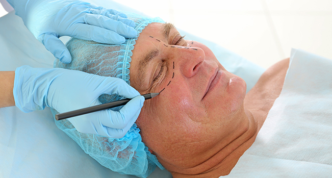 Person being prepared for blepharoplasty surgery