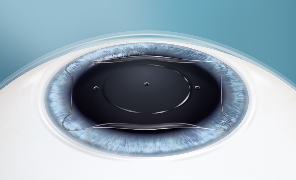 Advanced Vision Correction for Precision and Safety