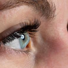 Is LASIK Surgery Possible for Keratoconus Patients